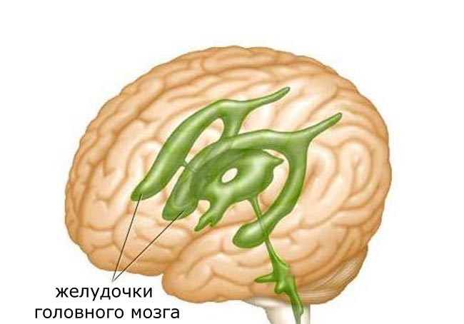 Боковые желудочки головного мозга рисунок